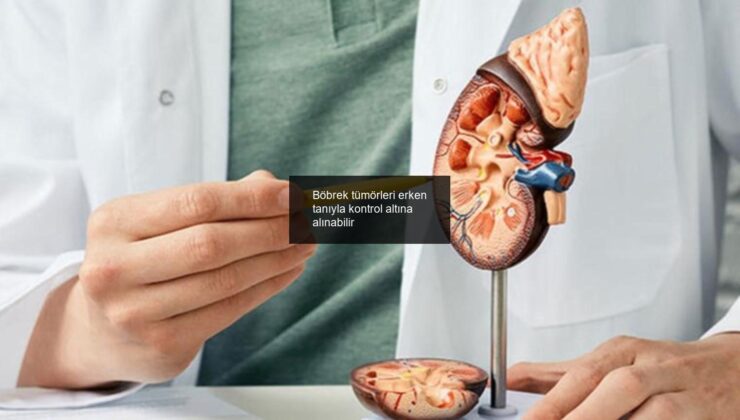 Böbrek tümörleri erken tanıyla kontrol altına alınabilir