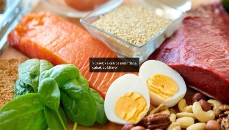 Yüksek kalorili besinler daha çabuk acıktırıyor