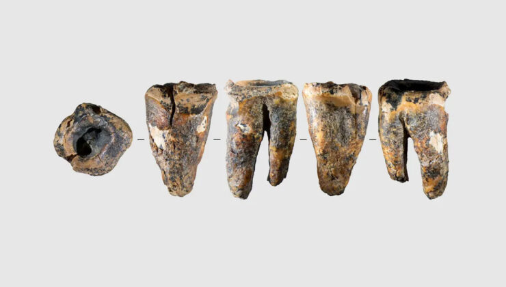 Neandertallerin Cerrahi İzleri: 59 Bin Yıllık Diş Müdahalesi