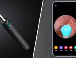Xiaomi’nin kameralı akıllı kulak temizleyicisi ile tanışın! [Video]