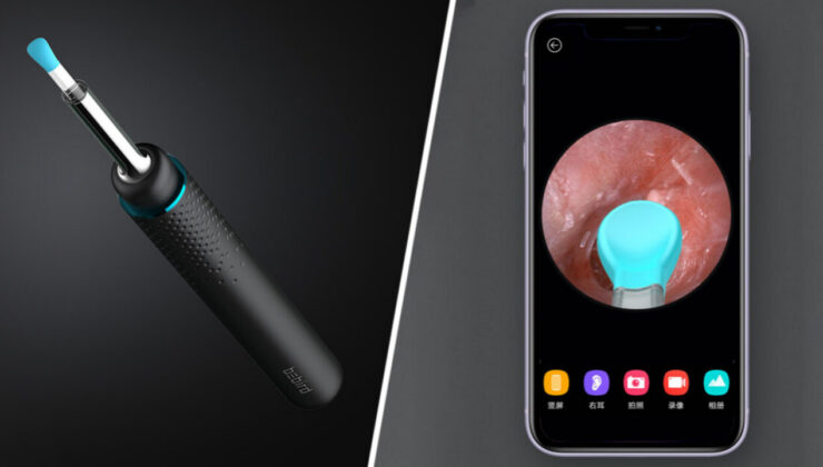 Xiaomi’nin kameralı akıllı kulak temizleyicisi ile tanışın! [Video]